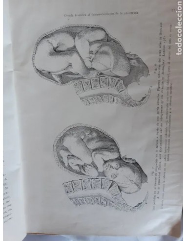 TRATADO COMPLETO DE OBSTETRICIA por...