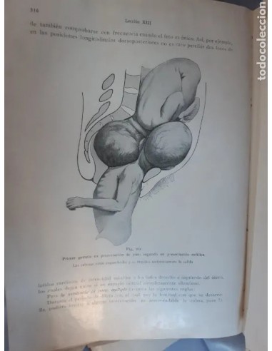 TRATADO COMPLETO DE OBSTETRICIA por...